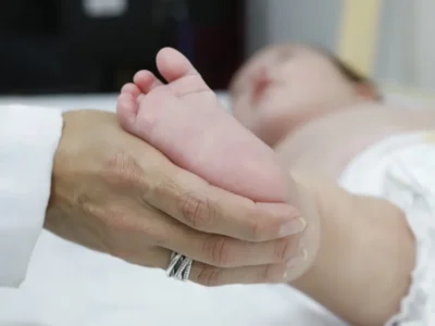 Atraso no teste do pezinho atrasa diagnóstico e tratamento da AME